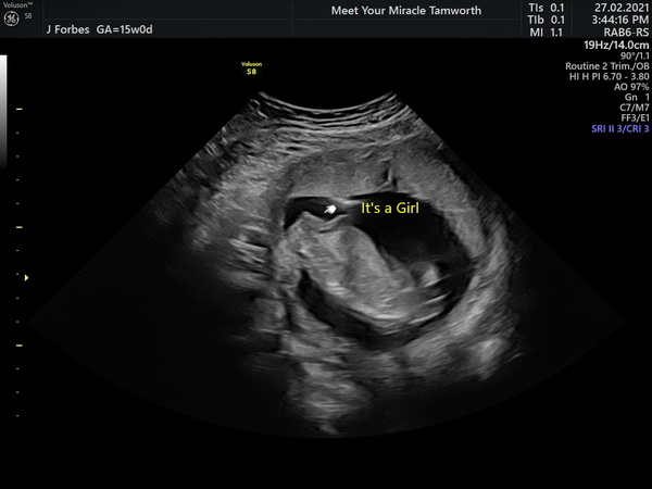 15 week scan images...