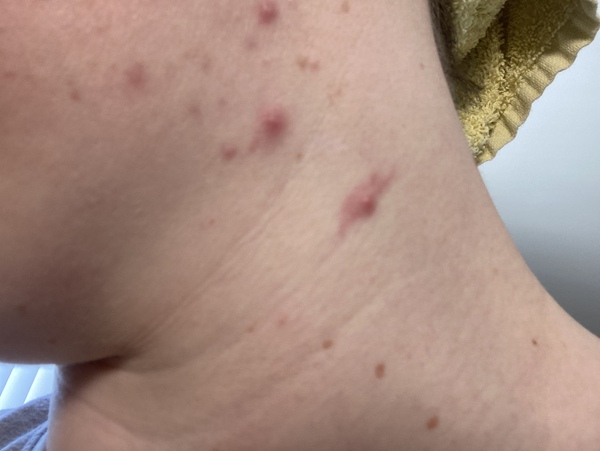 My skin- does this need investigated?