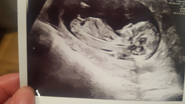 Do you want me to guess the sex? 12 week scans.