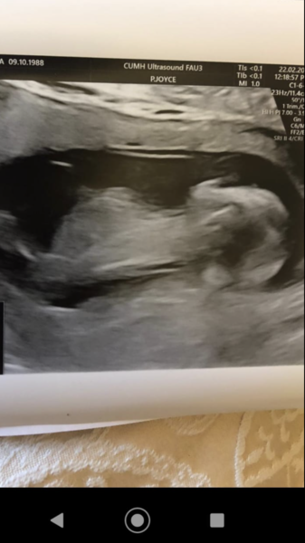 Do you want me to guess the sex? 12 week scans.