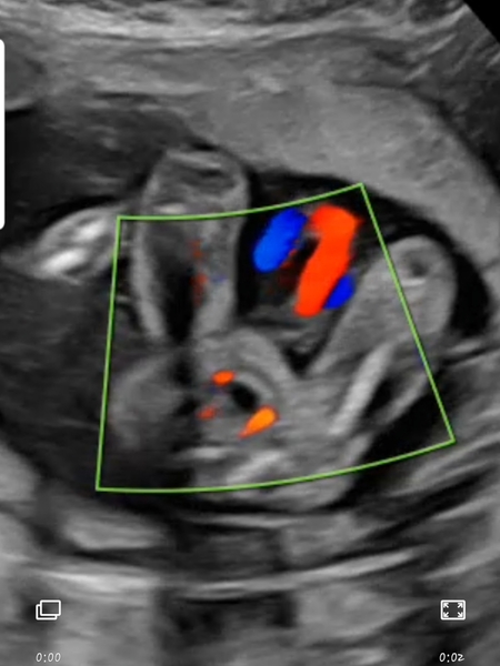 15 week scan images...