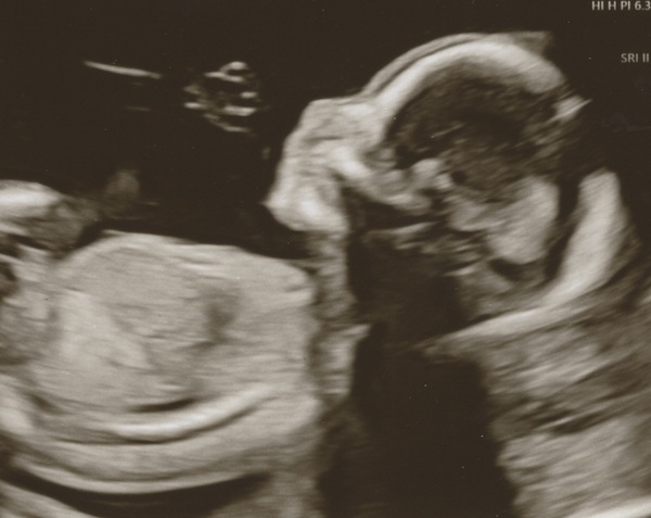 Aug 2021 - 2nd Trimester continues