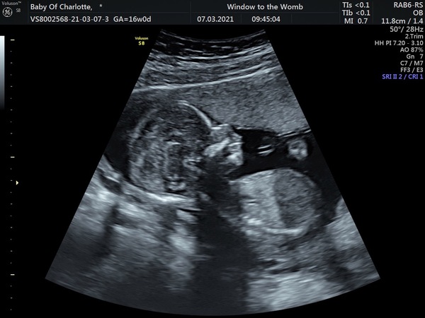 Aug 2021 - 2nd Trimester continues