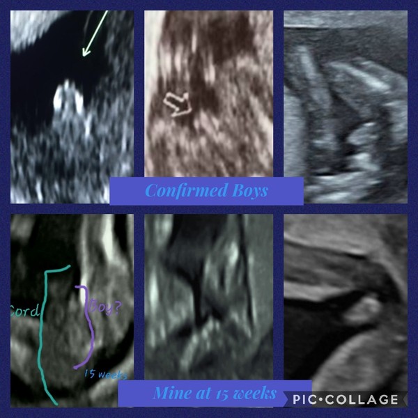 15 week scan images...