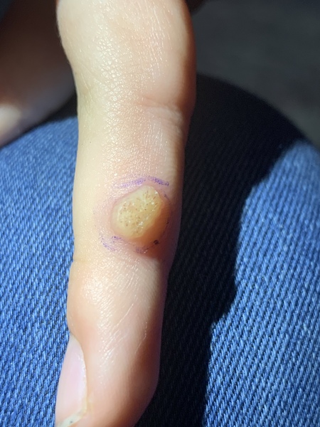What’s this on DD’s finger? (Pic included)