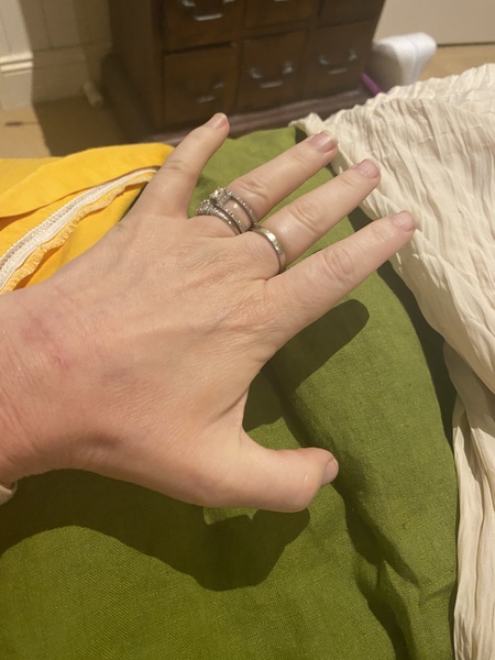 Anyone know what this might be?