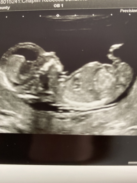 September 2021 thread 3 🥳