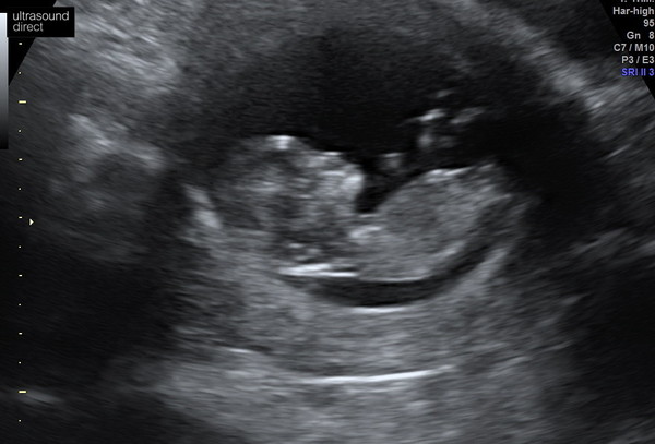 September 2021 thread 3 🥳
