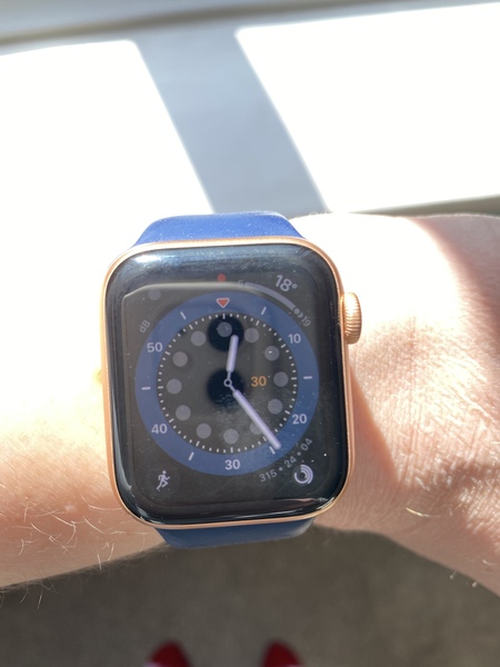 What size Apple Watch? Pic attached