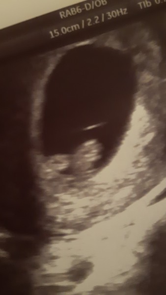 Baby measured at 7+1week when I thought 8+5