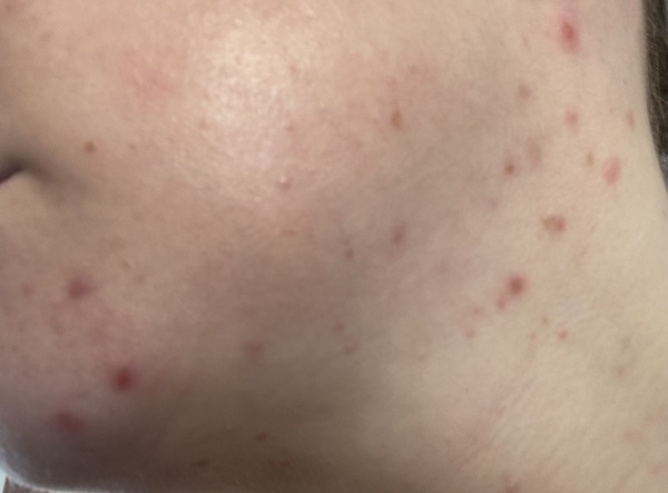 My skin- does this need investigated?