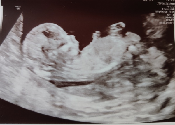 Due Sept/Oct 2021