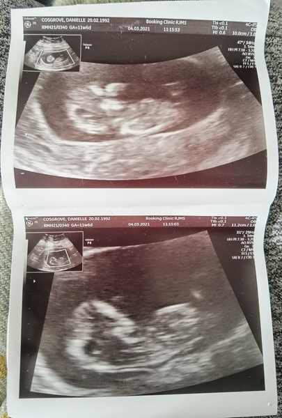 Do you want me to guess the sex? 12 week scans.