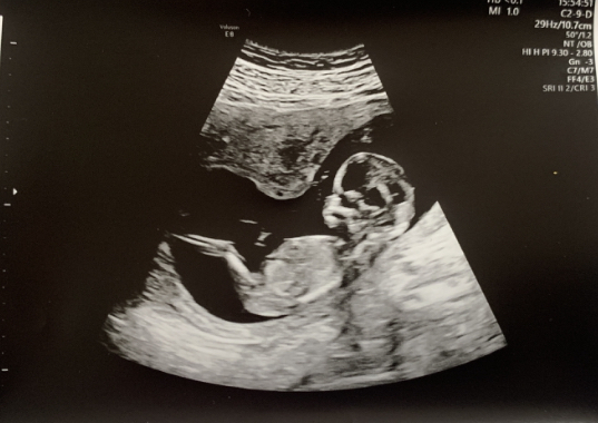 Just for fun - Girl or Boy?