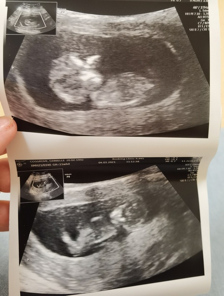 September 2021 thread 2🥳