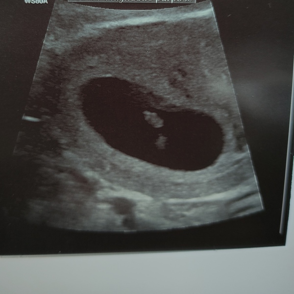 Due November 2021 - thread 2!