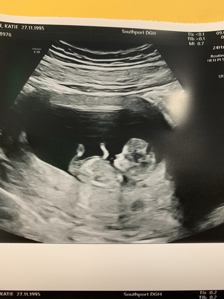 September 2021 thread 3 🥳