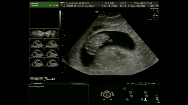 Due Sept/Oct 2021