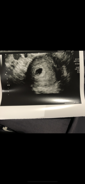First early scan