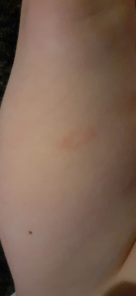 Weird spots/rash?
