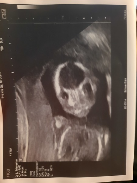 September 2021 thread 3 🥳