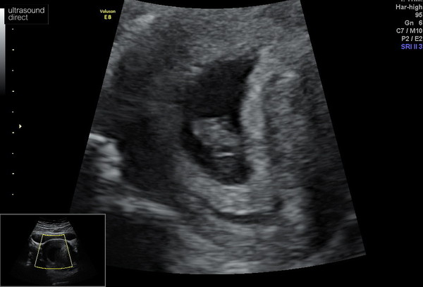 October 2021