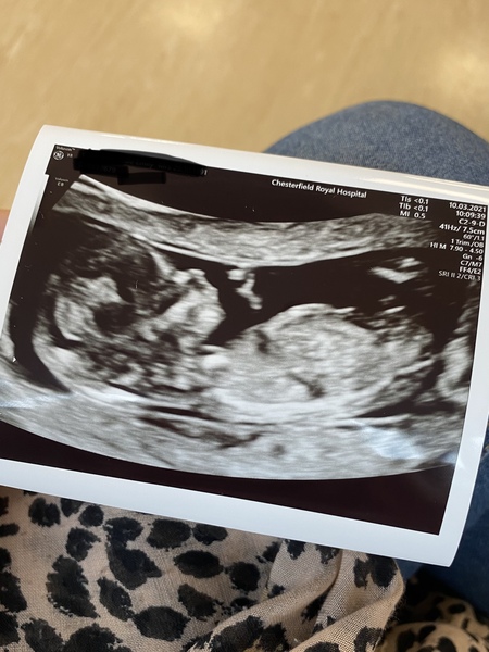 September 2021 thread 3 🥳