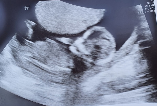 September 2021 thread 3 🥳