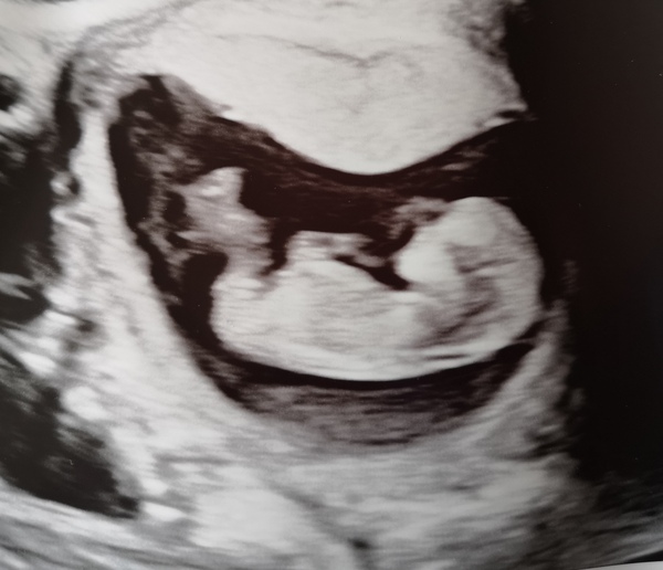 September 2021 thread 3 🥳