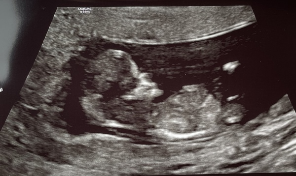 September 2021 thread 3 🥳