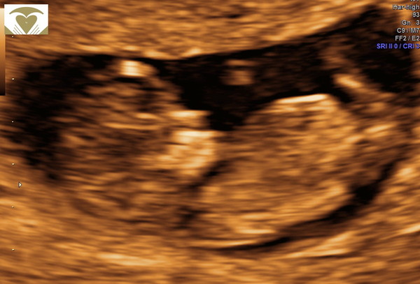 October 2021