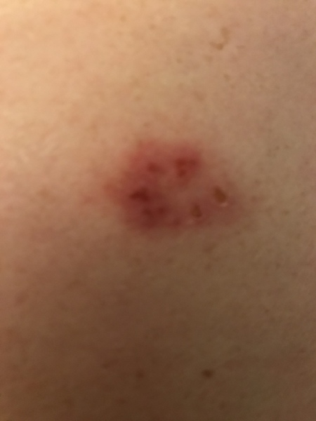 Help - what is this on my husband’s back?