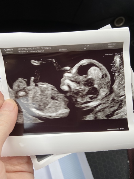 Do you want me to guess the sex? 12 week scans.