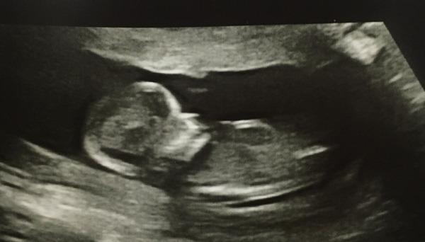 Help guess the gender!