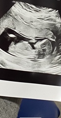 13 week scan gender guess?