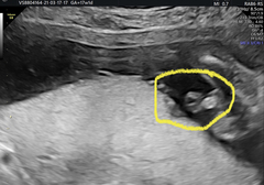 Gender Help !!!