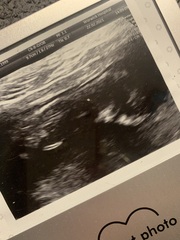 Do you want me to guess the sex? 12 week scans.