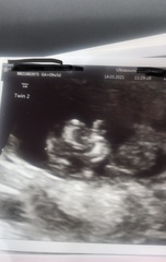 Pregnancy after loss - Autumn babies 2021 - Thread 2