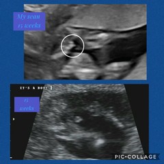 15 week scan images...