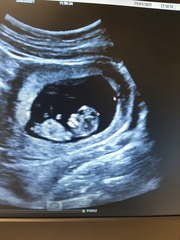 Gender guesses for my 12 week scan please