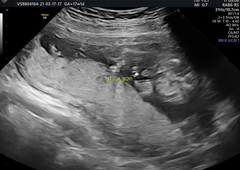 Gender Help !!!