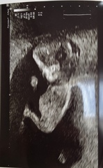 Gender Guess!