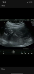 Do you want me to guess the sex? 12 week scans.