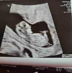 Do you want me to guess the sex? 12 week scans.