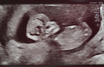 Due September - Any gender guesses?