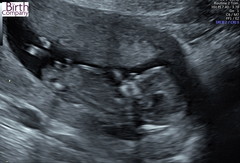 Do you want me to guess the sex? 12 week scans.