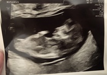 Gender Guess!