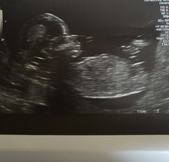 12 week scan... anyone wanna wait with me?