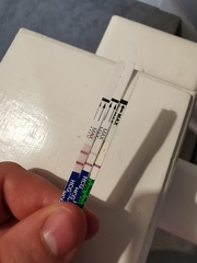 Pregnancy bleeding