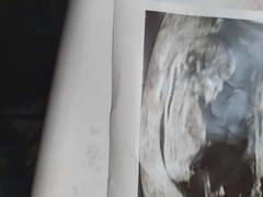 Do you want me to guess the sex? 12 week scans.